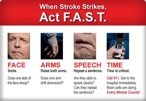 Campaign says act FAST – but surely closing stroke facilities at Yeovil will only slow things down?